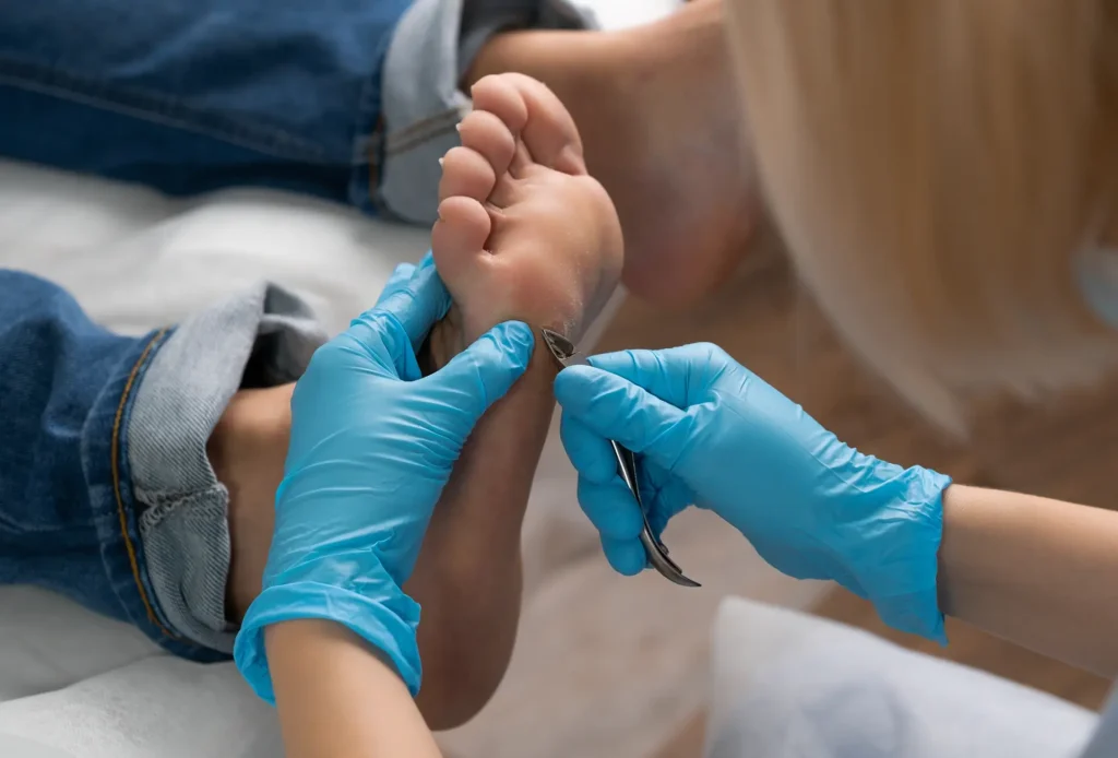 Pixie Footcare Mobile Footcare Yoevil 02